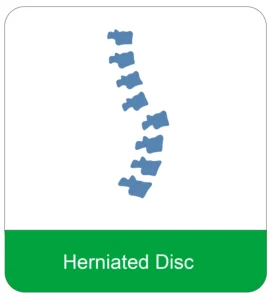 Herniated Disc Treatment at Elite Chiropractic Beverly Hills
