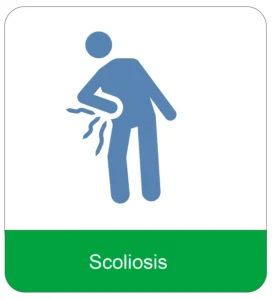 Scoliosis Treatment at Elite Chiropractic Beverly Hills